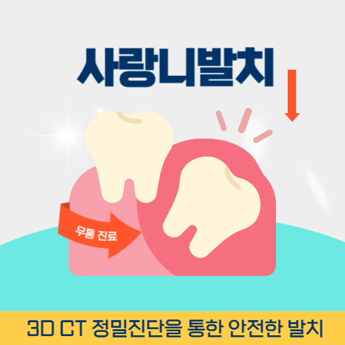 청주치과 청주시 치과 사랑니 발치